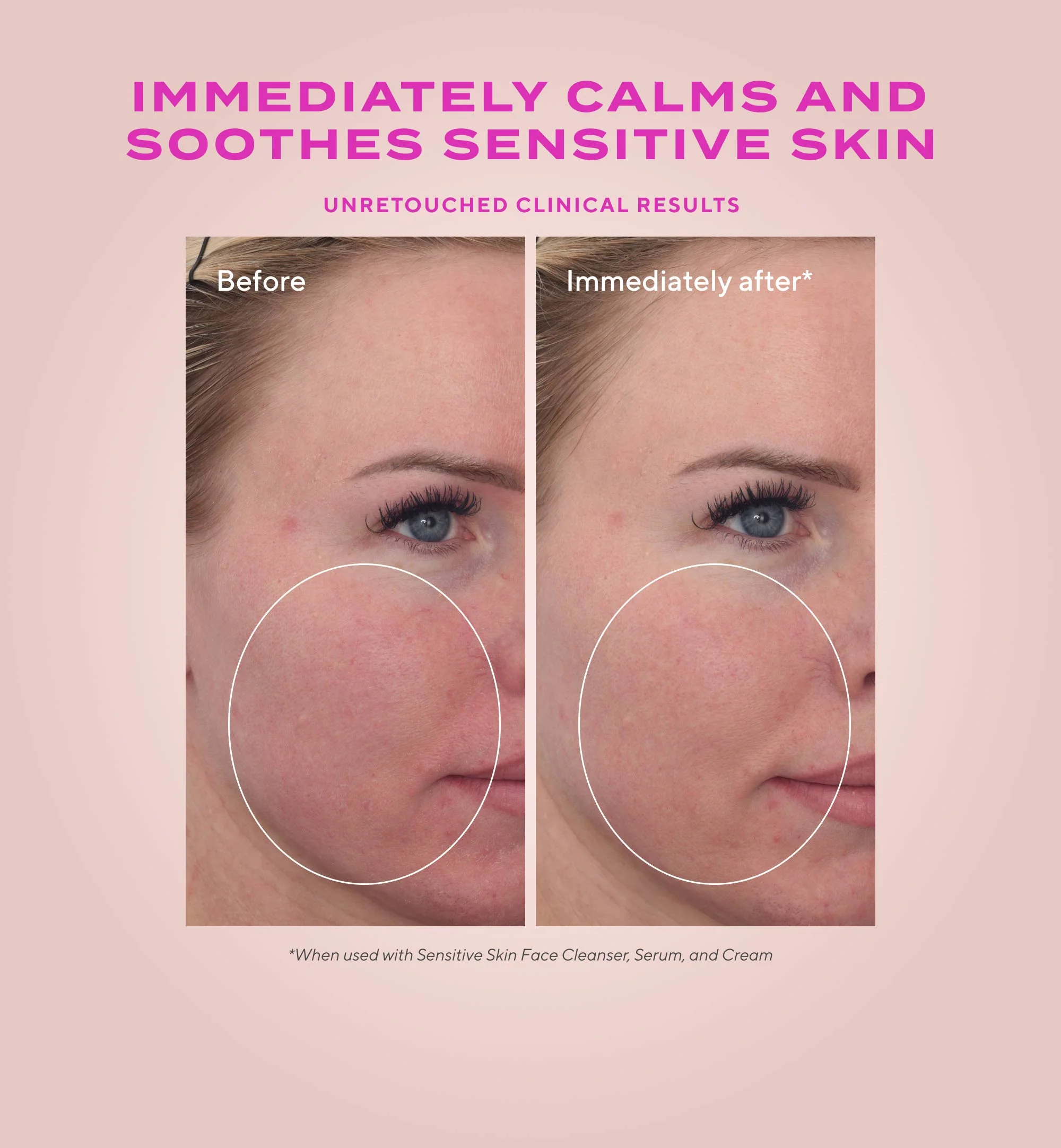 Heartleaf Calming cream - Afbeelding 2