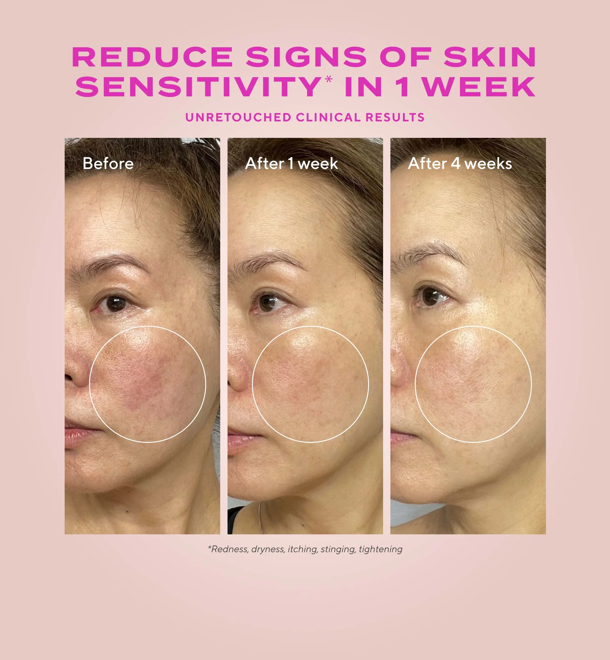 Heartleaf Gentle Resurfacing serum - Afbeelding 3