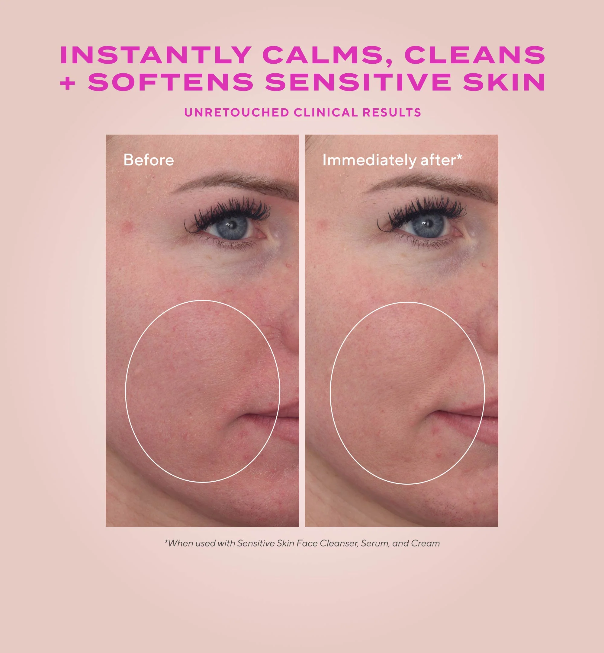 Heartleaf Soothing face cleanser voor de gevoelige huid & eczeem huid - Afbeelding 3