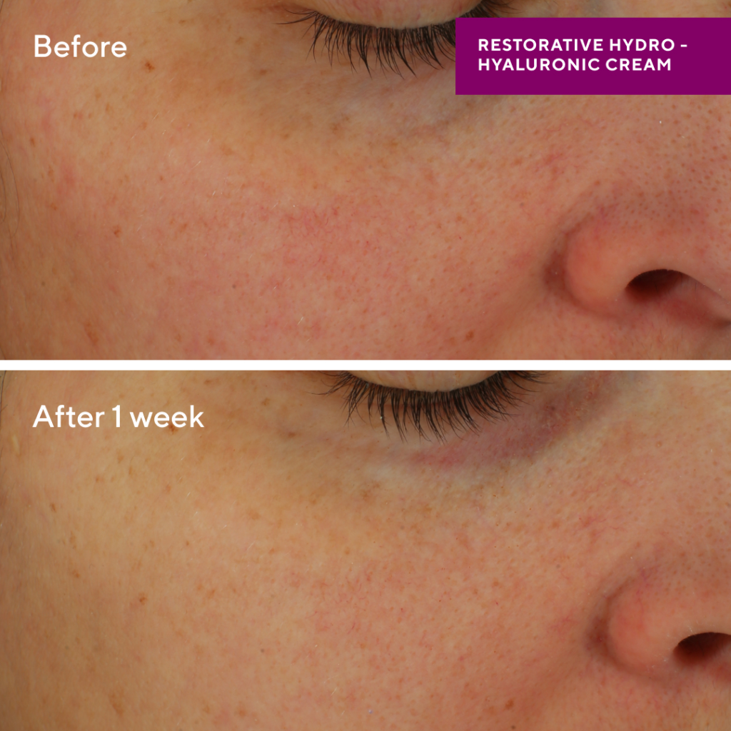 Restorative Hydro-Hyaluronic cream - Afbeelding 2